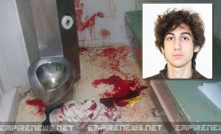 Accused-Boston-Marathon-Bomber-Severely-Injured-In-Prison-May-Never-Walk-Or-Talk-Again.jpg